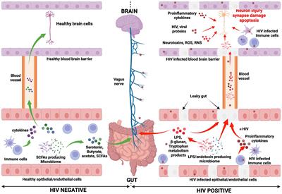 HIV-associated neurocognitive disorder: key implications of the microbiota-gut-brain axis